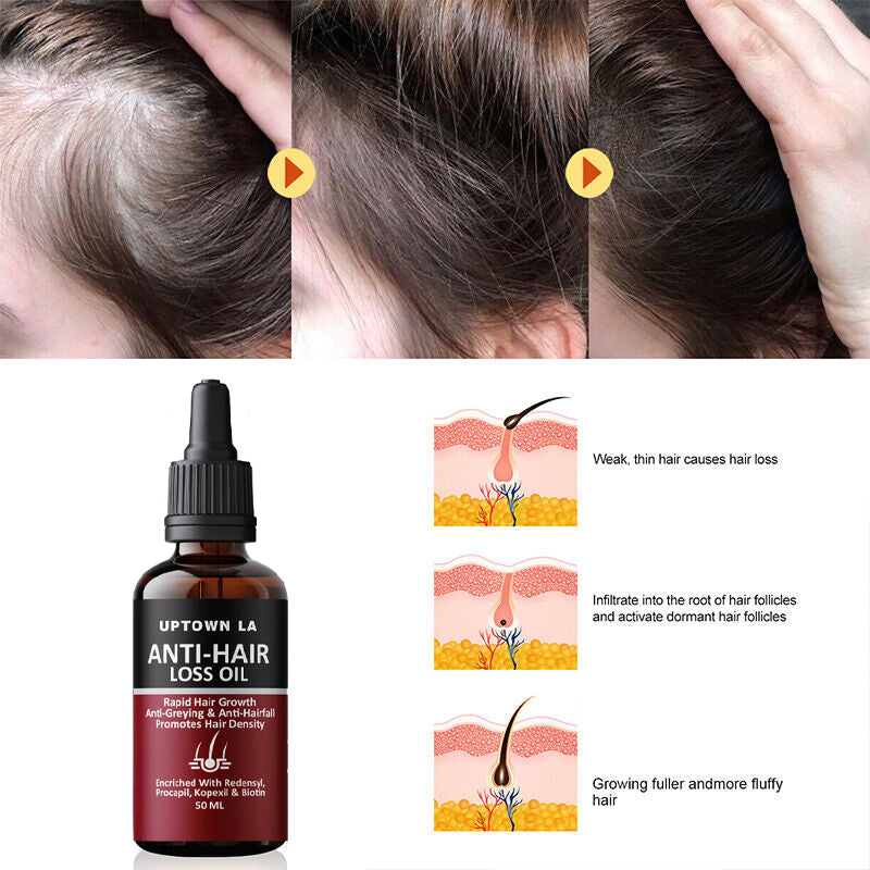 Uptown La Anti-Hair Loss Serum My Store