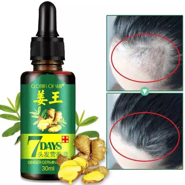 Nourishing Hair Growth Serum 30ml My Store
