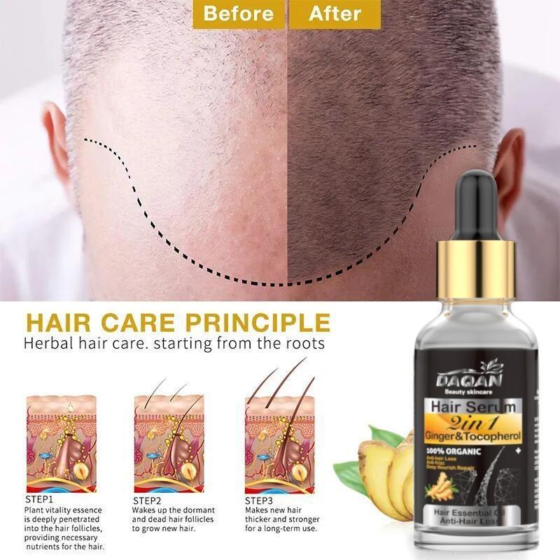 Dagian Anti-Hair Loss Serum (30ml) My Store