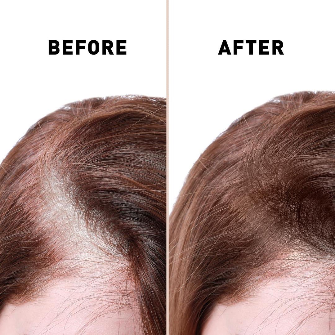 Dagian Anti-Hair Loss Serum (30ml) My Store