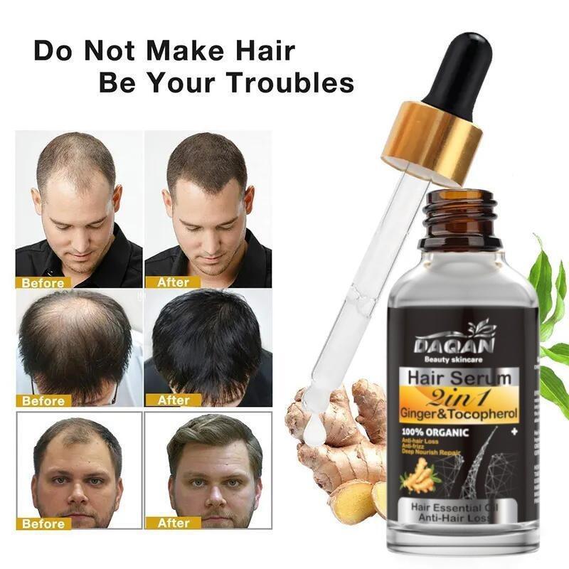 Dagian Anti-Hair Loss Serum (30ml) My Store