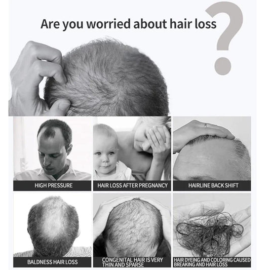 Disaar Anti-Hair Loss Spray 30ml – Reduce Hair Fall & Strengthen Roots My Store