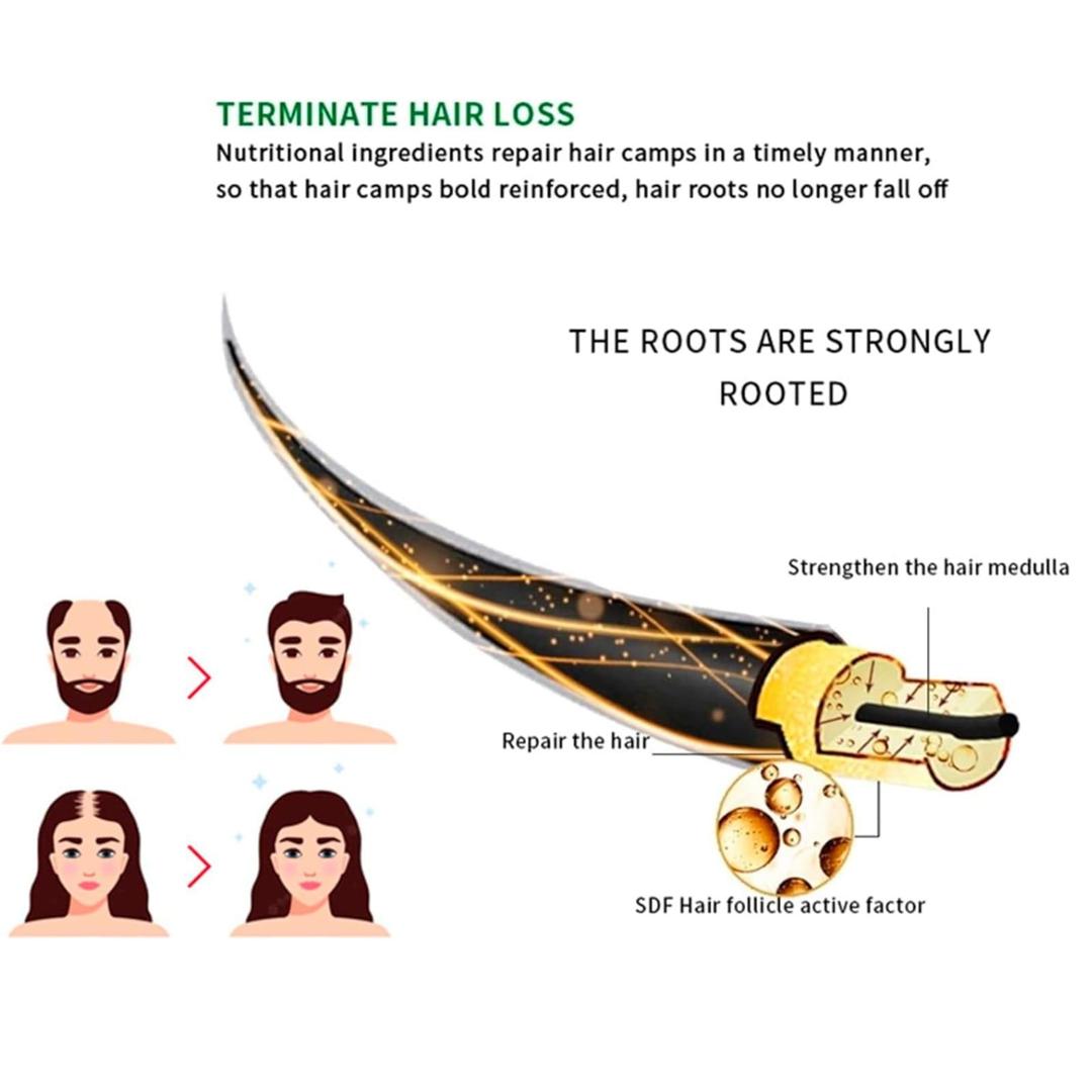 Disaar Anti-Hair Loss Spray 30ml – Reduce Hair Fall & Strengthen Roots My Store