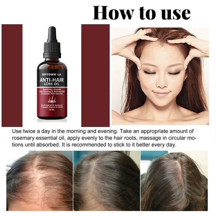 Uptown La Anti-Hair Loss Serum My Store